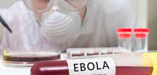 Ebola: zer jakin behar dogu?